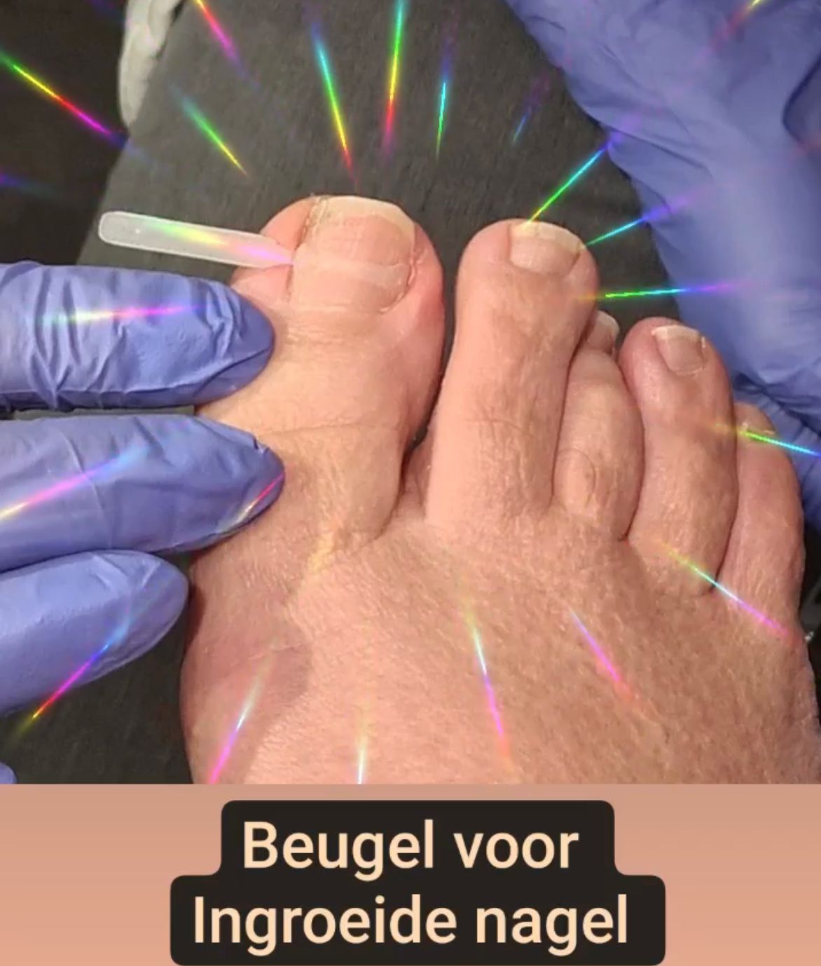 Nagelbeugel